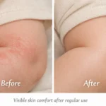 Lavanya baby Balm Kawakawa